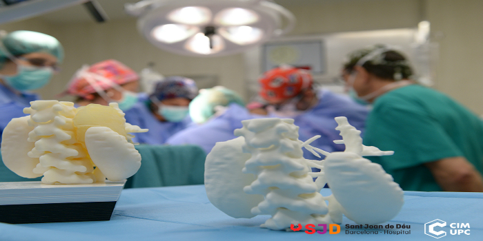 El CIM UPC organiza la primera jornada sobre impresión  3D quirúrgica, QuirofAM
